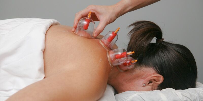 Myofascial Cupping