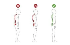 Good and bad posture for upper cross syndrome