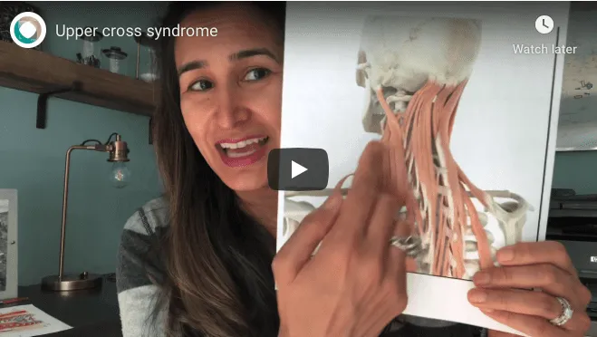 UCS - upper cross syndrome