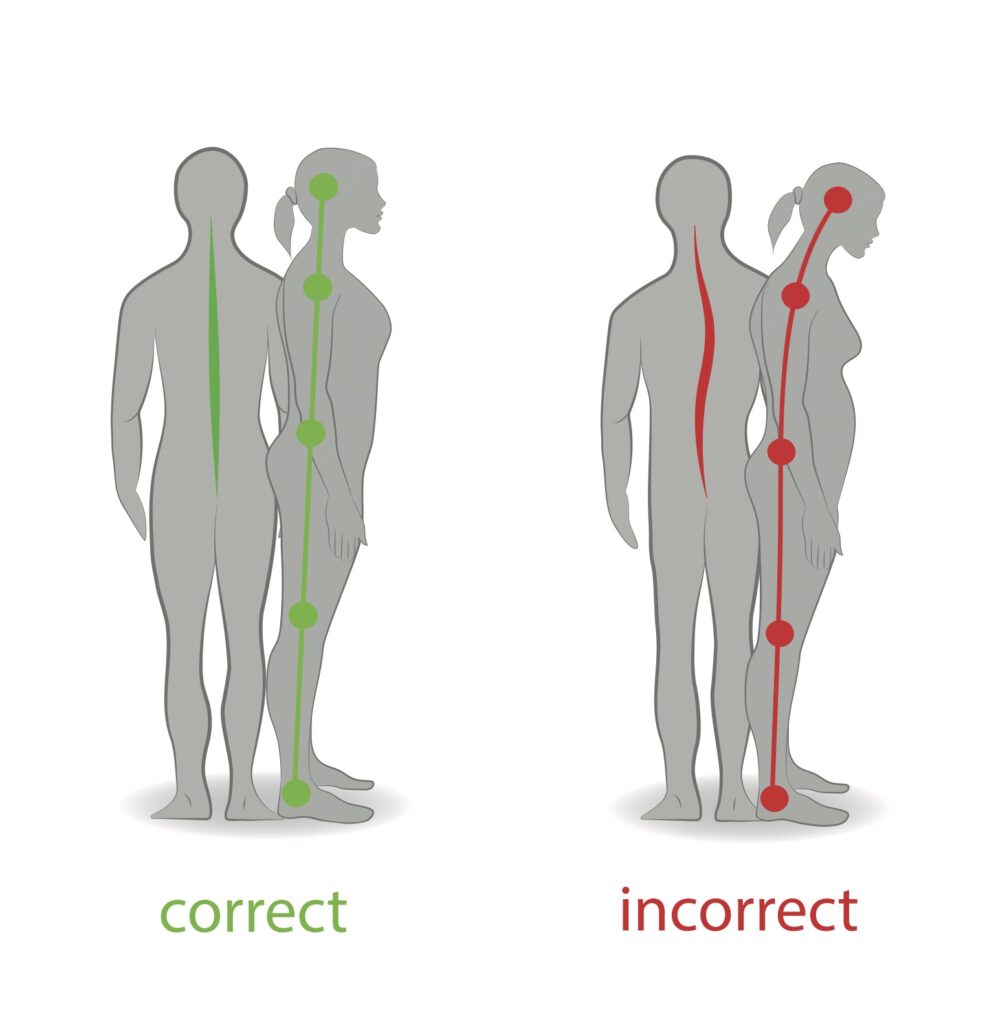 Could Poor Posture Be Causing Your Back Pain? This Graphic Reveals If  You're Standing Correctly